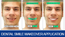 Dentist Sterling Heights - Dental Smile Makeover Application